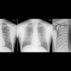 GE Dual Energy Subtraction 1 |