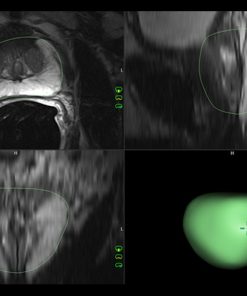 GE Invivo® DynaCAD® Prostate