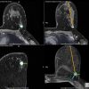 GE Invivo® DynaCAD® Breast Software