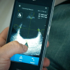 GE Vscan Extend™ Bladder Volume App 1 |