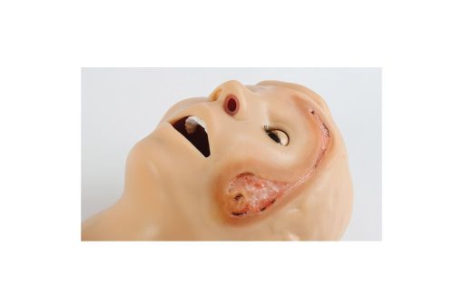 MANIKIN LUKA BAKAR ANAK 1 Manikin luka bakar anak
