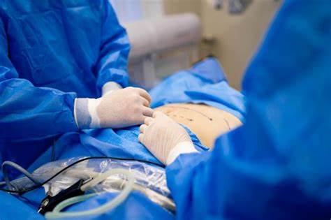 Manikin pelatihan Operasi Caesar