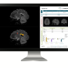 GE icobrain ms 1 |