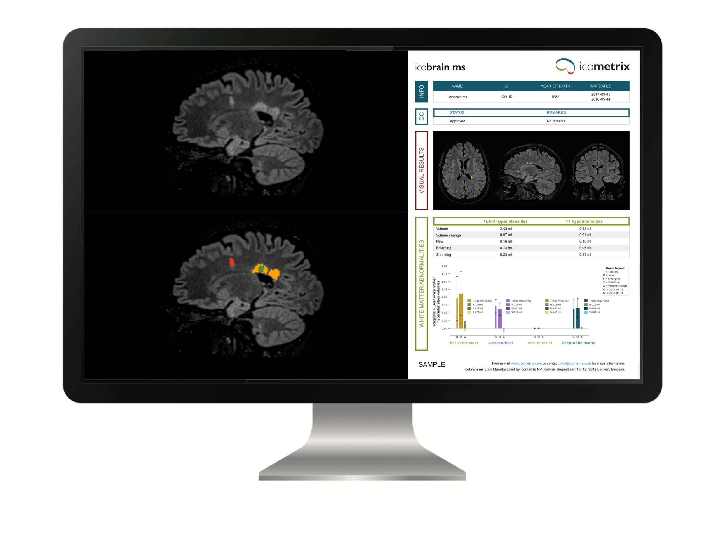 Mon_icobrain_ms-2 |
