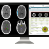 GE icobrain tbi 1 |