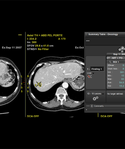 GE OncoQuant™