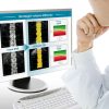 GE TBS iNsight™ 2 |