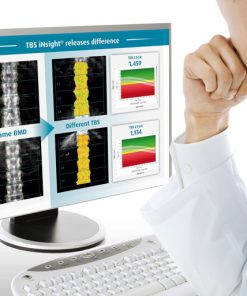GE TBS iNsight™