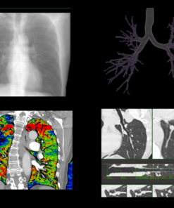 GE Thoracic VCAR