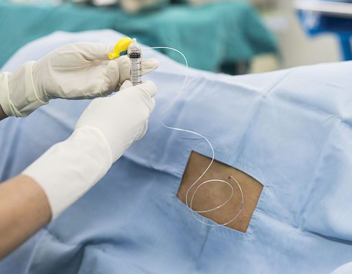 Simulator prosedur Anestesi Epidural