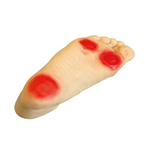 Manikin Perawatan Pasien Diabetes