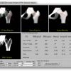 GE Mindways QCT PRO 3D BMD Package 1 |