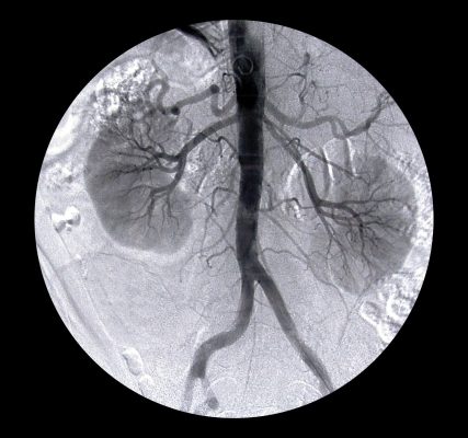 Simulator Pelatihan Prosedur Arteriografi