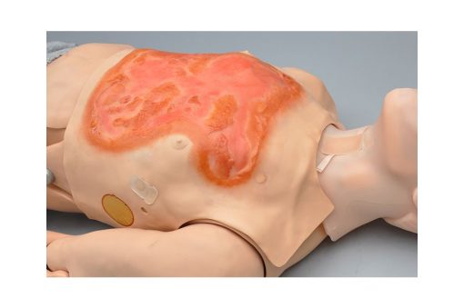 Manikin Pertolongan Pertama untuk Pasien Luka Bakar