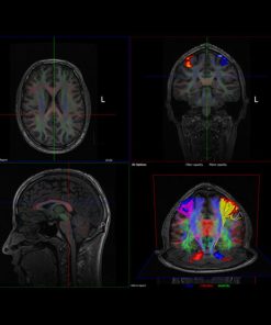 GE NordicNeuroLab nordicBrainEx