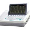 ECG iBeat 12V Grand - 12 Channel ECG 2 |