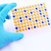 Enzymatic Immuno Assays (EIA) 1 |