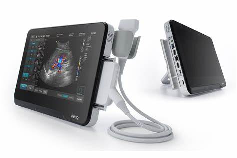 fungsi ultrasound portabel