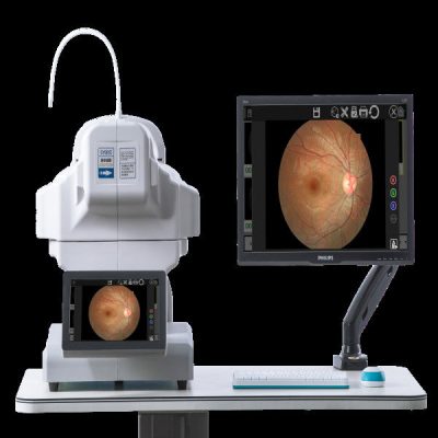 High-Resolution Fundus Camera