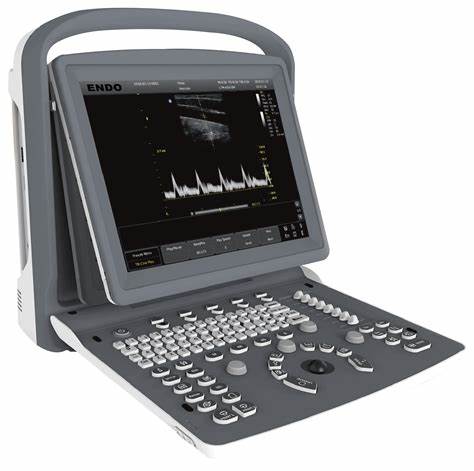 ULTRASOUND DIAGNOSTIC SYSTEM EI.USGBW: KEUNGGULAN, FITUR, DAN SPESIFIKASI 1 Ultrasound Diagnostic System EI.USGBW