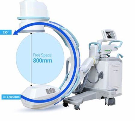 X-Ray C-Arm for Advanced Imaging