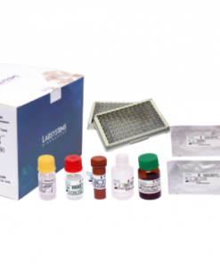 Neoscreen Galactose: Tes Screening Galaktosemia Akurat
