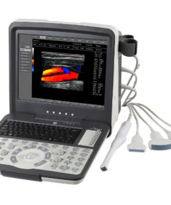 Portable Color Doppler Ultrasound Scanner L-6018I