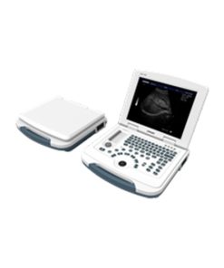 Portable Color Doppler Ultrasound Scanner W-58 - Alat USG Portabel