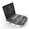 Doppler Portable Ultrasound Scanner C350 1 |