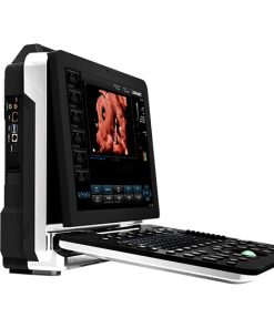Portable Color Doppler Ultrasound Scanner C-70 – Terbaik