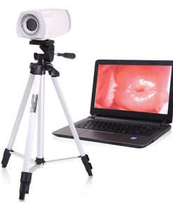Portable Video Colposcope MT-9800 – Alat Diagnostik Ginekologi