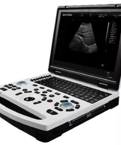 Mesin Ultrasound Portable US-B690 Full-Digital Hitam Putih