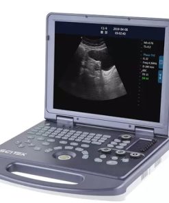Mesin Ultrasonografi Portable Hitam Putih Digital US-B60