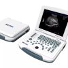 Portable Ultrasound Scanner B&W US-B580 | Syaf Indonesia 1 |