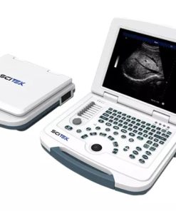 Portable Ultrasound Scanner B&W US-B580 | Syaf Indonesia