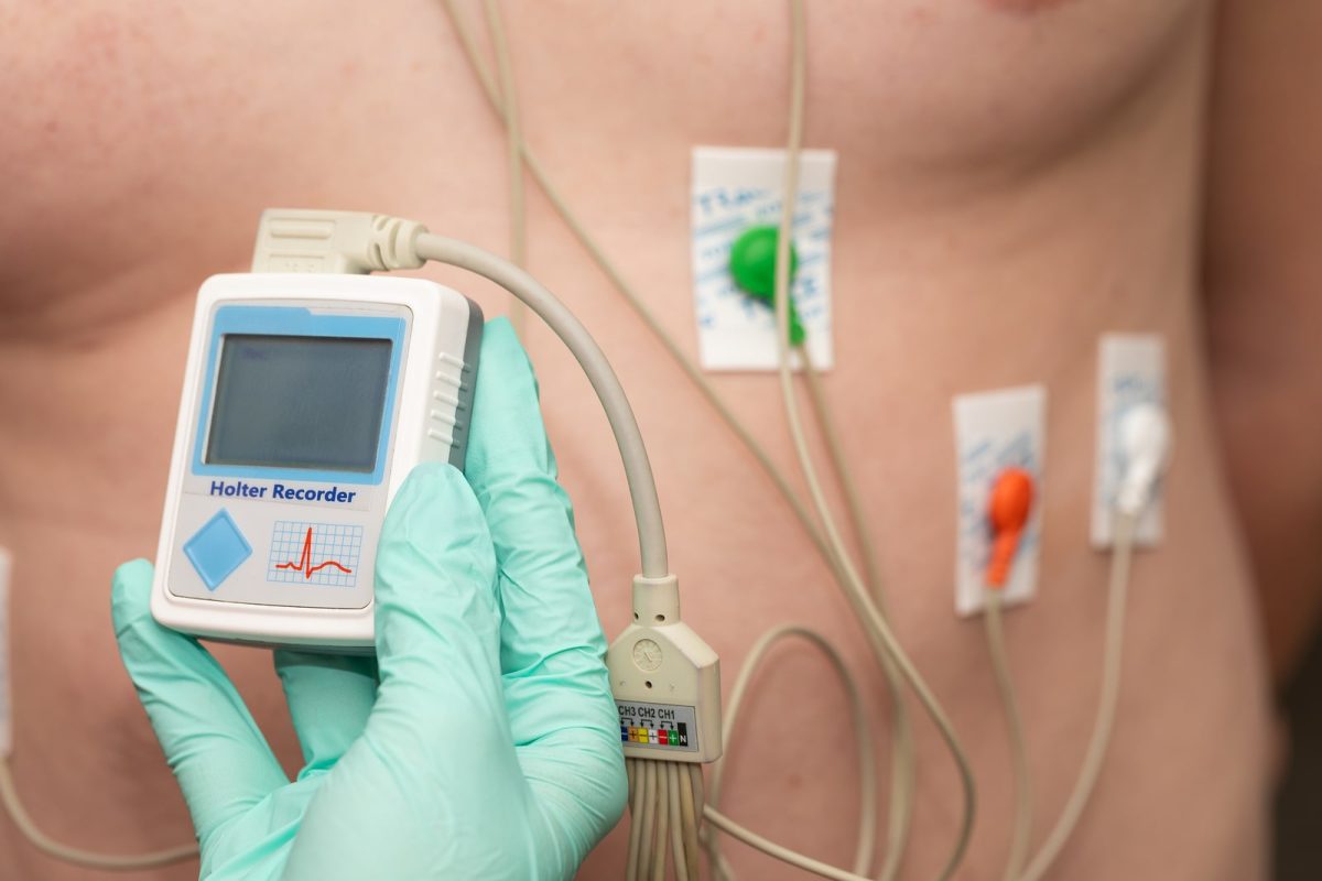 Holter Monitor