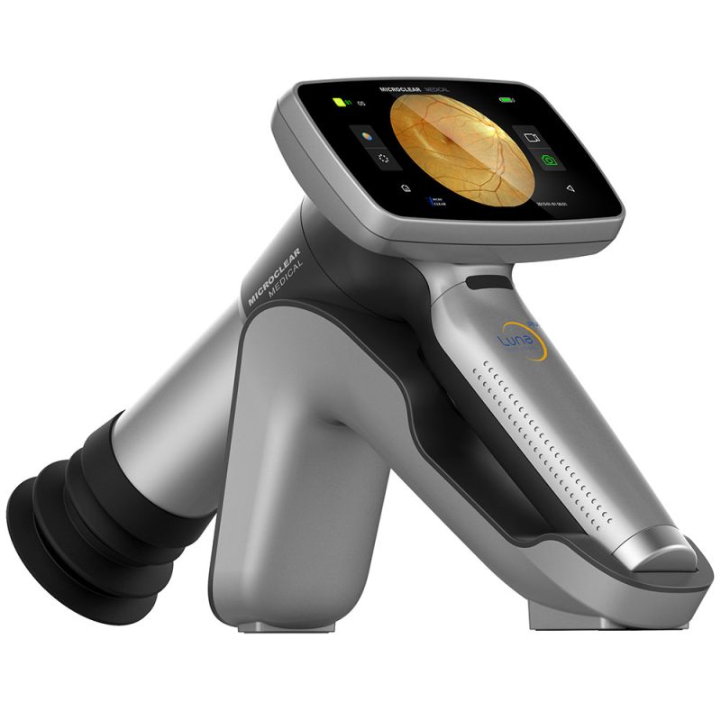Cara Menggunakan Fundus Camera: Panduan Lengkap 2024 1 fundus camera