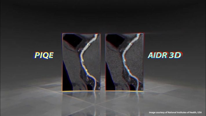 Precise IQ Engine