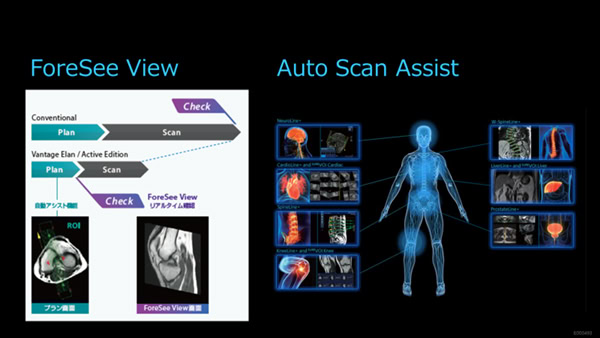 Vantage Elan Active Edition