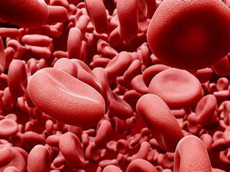 Therapeutic Apheresis Red Blood Cell Exchange