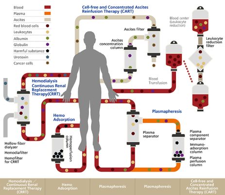 Therapeutic Apheresis Red Blood Cell Exchange