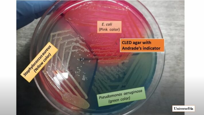 E. coli berwarna pink, stir lays di agar CLED dengan indikator Anderson, menunjukkan keberhasilan pertumbuhan dan identifikasi bakteria di media kultur.