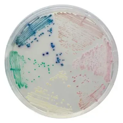 Candida Chromagar
