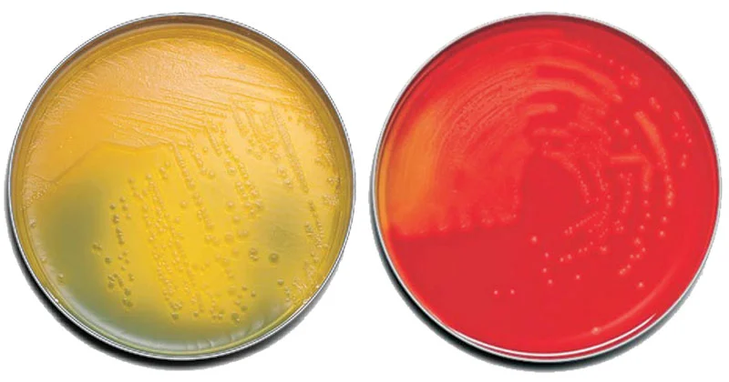 Tryptic Soy Agar