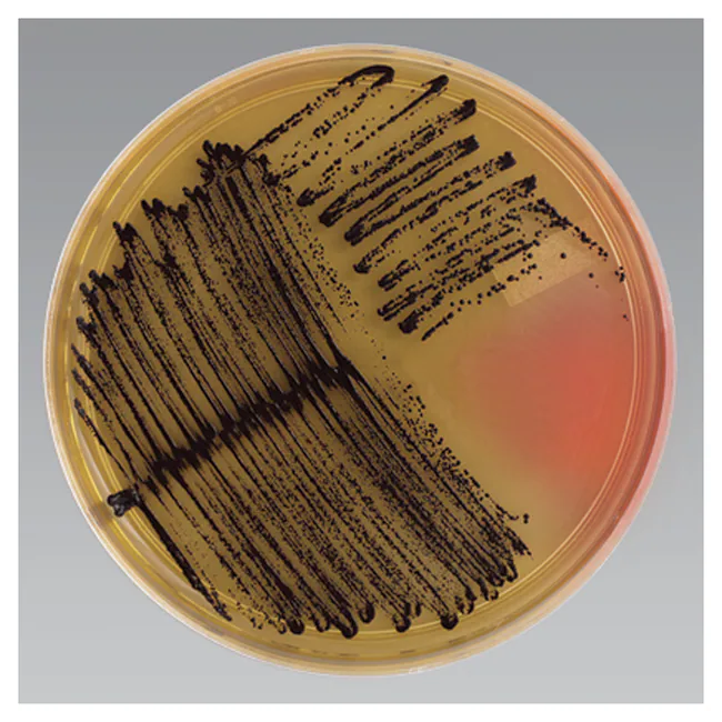 Vogel Johnson Agar: Fungsi, Komposisi & Cara Pakai 1 Vogel Johnson Agar