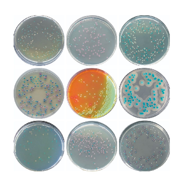 Staphylococcus aureus Chromogenic Medium: Panduan Lengkap 1 Staphylococcus aureus Chromogenic Medium