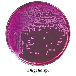 Shigella Chromogenic Medium