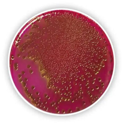 cara menggunakan Endo Agar