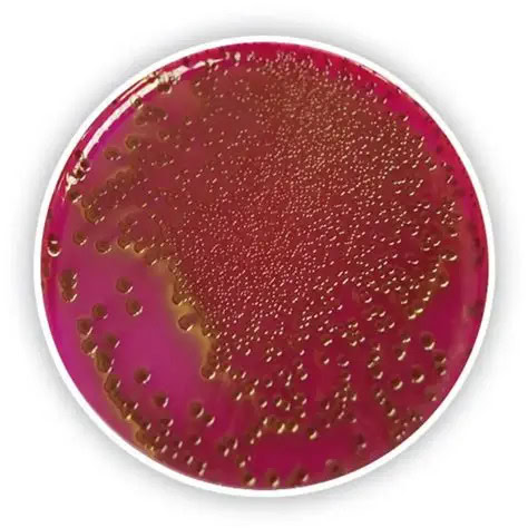7 Cara Menggunakan Endo Agar yang Benar untuk Uji Mikrobiologi 1 cara menggunakan Endo Agar