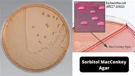 Sorbitol MacConkey Agar